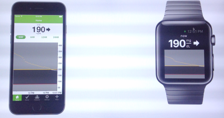 dexcom-aplikacja-apple-watch