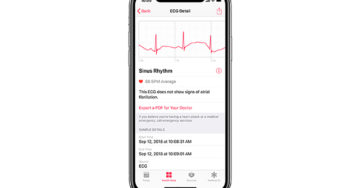 Apple Watch wykryje ryzyko udaru mózgu? Apple rozpoczyna wspólne badania z Johnson & Johnson