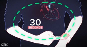 Zobacz, jak działa EKG na Apple Watchu